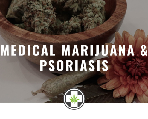 cannabis for psoriasis